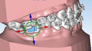 Digital Orthodontics Market, Digital Orthodontics, Orthodontics Market, Digital Orthodontics Market Analysis, Digital Orthodontics Market Share, Digital Orthodontics Market Growth, Digital Orthodontics Market Value